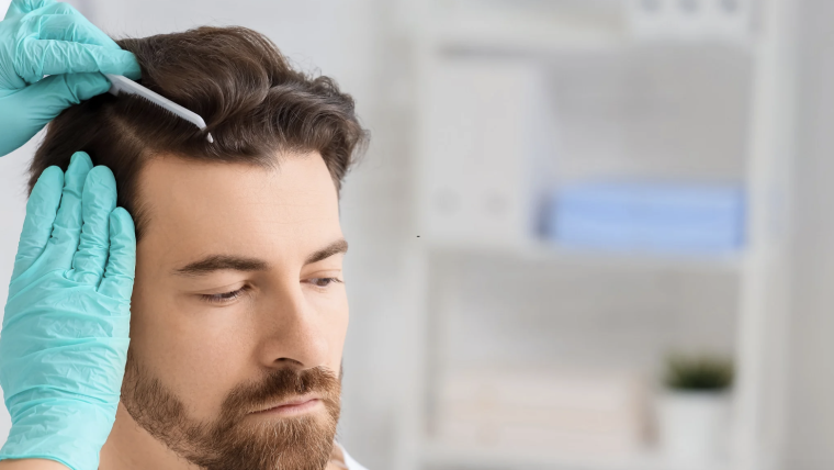 Hair Loss Evaluation Near Wolf Trap, VA